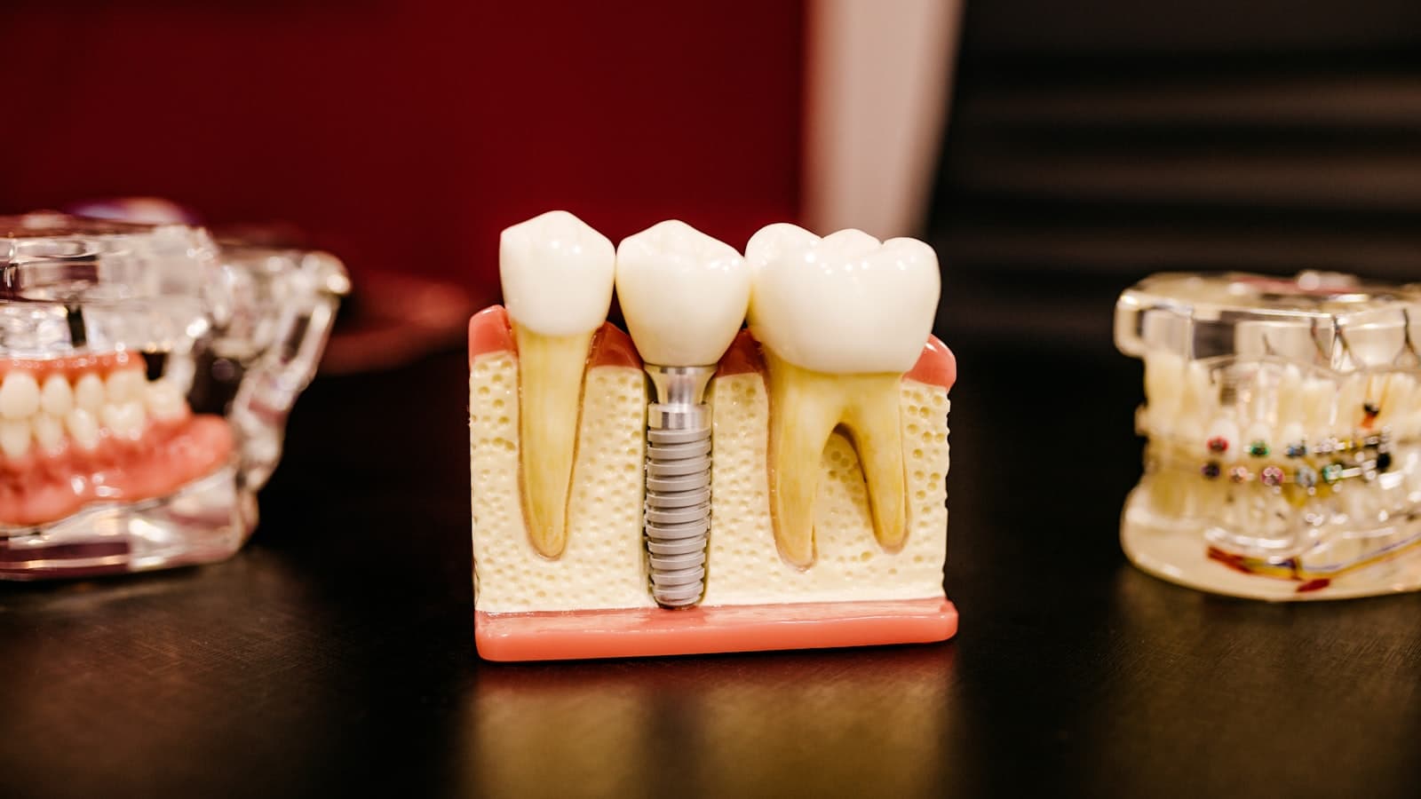 ORE Part 2 Preparation: A Guide for Overseas Dentists